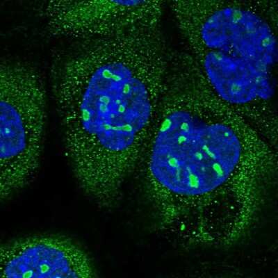 Immunocytochemistry/ Immunofluorescence: KNOP1 Antibody [NBP2-48730]