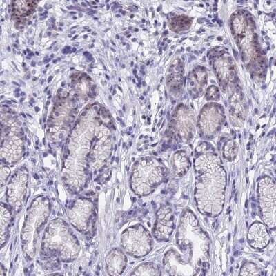 Immunohistochemistry-Paraffin: KNOP1 Antibody [NBP2-48730]