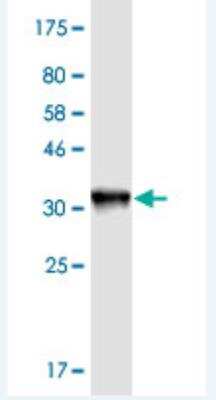 Western Blot: KNTC1 Antibody (10D9) [H00009735-M02]