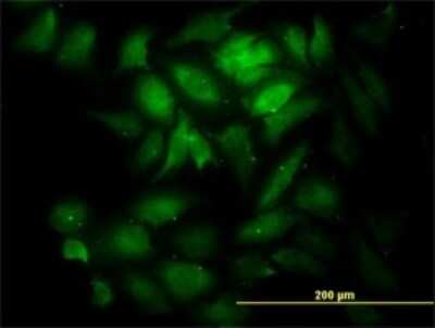 Immunocytochemistry/ Immunofluorescence: KNTC1 Antibody (10H4) [H00009735-M01]