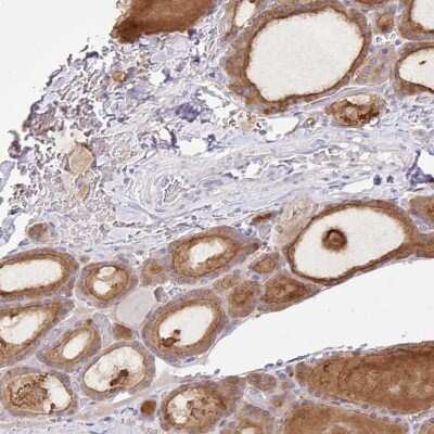 Immunohistochemistry-Paraffin: KOX2 Antibody [NBP2-46835]