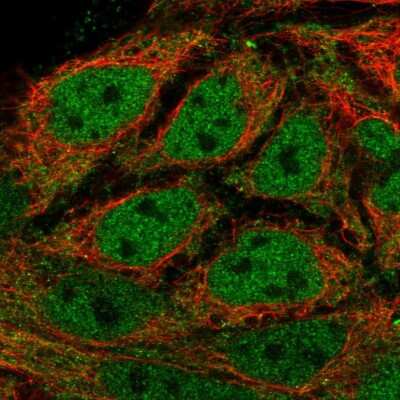 Immunocytochemistry/ Immunofluorescence: KPNA3 Antibody [NBP2-14172]