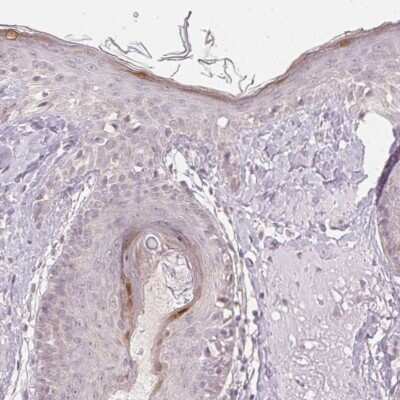 Immunohistochemistry: KPRP Antibody [NBP2-38194]