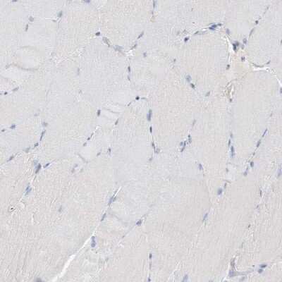 Immunohistochemistry-Paraffin: KPRP Antibody [NBP1-90707]