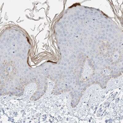 Immunohistochemistry-Paraffin: KPRP Antibody [NBP1-90707]