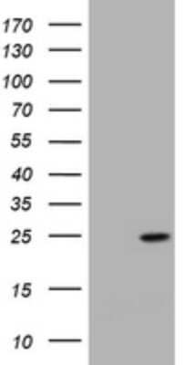 Western Blot: KRAS Antibody (OTI1D1) [NBP2-45535]