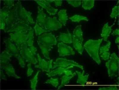 Immunocytochemistry/ Immunofluorescence: KRAS Antibody (3B10-2F2) [H00003845-M01]