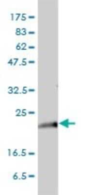 Western Blot: KRAS Antibody (3B10-2F2) [H00003845-M01]