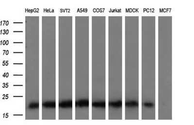 Western Blot: KRAS Antibody (OTI2C1)Azide and BSA Free [NBP2-71079]