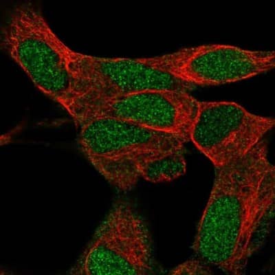 Immunocytochemistry/ Immunofluorescence: KRBA1 Antibody [NBP2-58786]