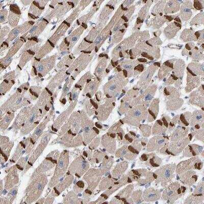 Immunohistochemistry-Paraffin: KRBA2 Antibody [NBP1-86005]