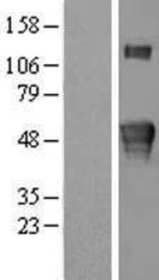 Western Blot: Kremen-2 Overexpression Lysate [NBL1-12378]
