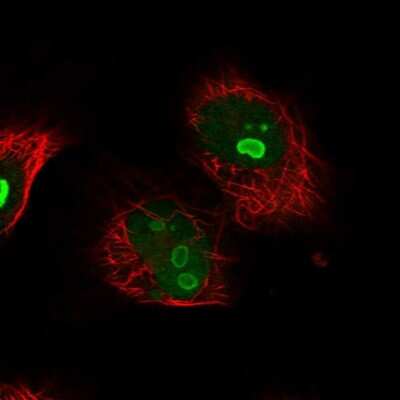 Immunocytochemistry/ Immunofluorescence: KRR1 Antibody [NBP1-92060]
