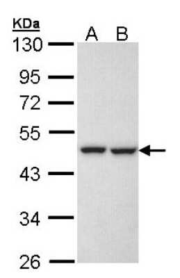 Western Blot: KRR1 Antibody [NBP1-32859]