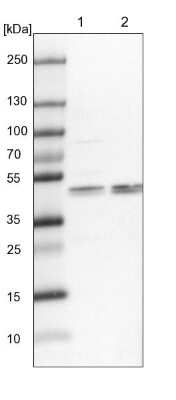 Western Blot: KRR1 Antibody [NBP1-92060]