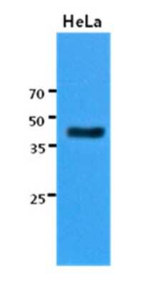 Western Blot: KRT23 Antibody (2F6)BSA Free [NBP2-22590]