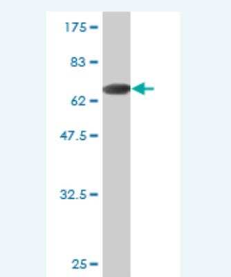 Western Blot: KRT23 Antibody (4H3-3D2) [H00025984-M02]