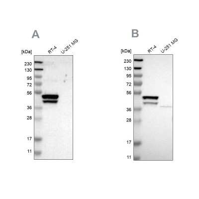 Western Blot: KRT23 Antibody [NBP1-85596]