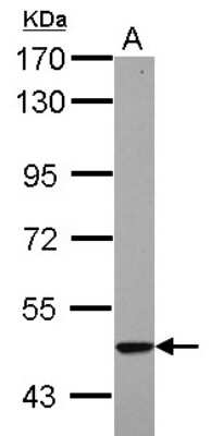 Western Blot: KRT23 Antibody [NBP2-19308]