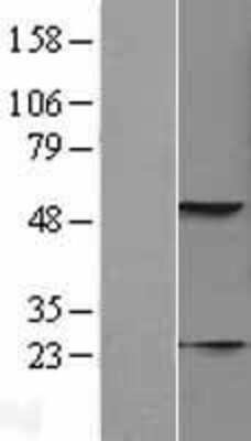Western Blot: KRT23 Overexpression Lysate [NBL1-12389]