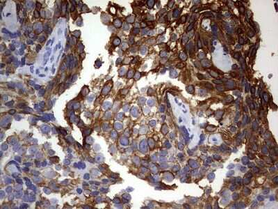 Immunohistochemistry: KRT24 Antibody (OTI4E8) [NBP2-45558]