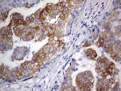 Immunohistochemistry: KRT24 Antibody (OTI4E8) [NBP2-45558]