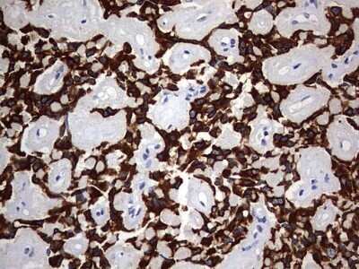 Immunohistochemistry: KRT24 Antibody (OTI4E8) - Azide and BSA Free [NBP2-72455]