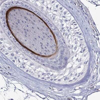 Immunohistochemistry-Paraffin: KRT40 Antibody [NBP3-17598]
