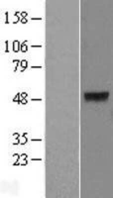 Western Blot: KRT40 Overexpression Lysate [NBP2-04858]