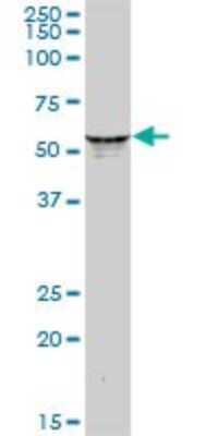 Western Blot: KRT6L Antibody [H00338785-B01P]