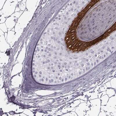 Immunohistochemistry-Paraffin: KRT74 Antibody [NBP2-14645]