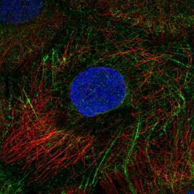 Immunocytochemistry/ Immunofluorescence: KRT80 Antibody [NBP2-58851]