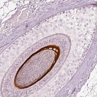 Immunohistochemistry-Paraffin: KRT82 Antibody [NBP2-31727]