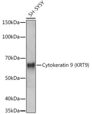Western Blot: KRT9 Antibody (9A5H3) [NBP3-16841]