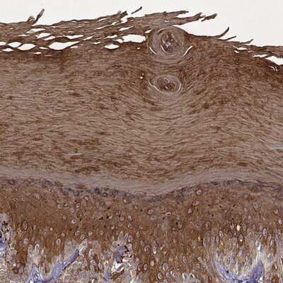 Immunohistochemistry-Paraffin: KRT9 Antibody [NBP1-94099]