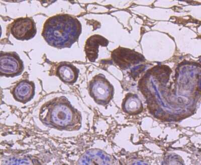 Immunohistochemistry-Paraffin: KRT9 Antibody (SD201-09) [NBP2-67810]