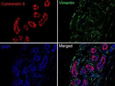 Immunohistochemistry-Paraffin: KRT9 Antibody (SD201-09) [NBP2-67810]