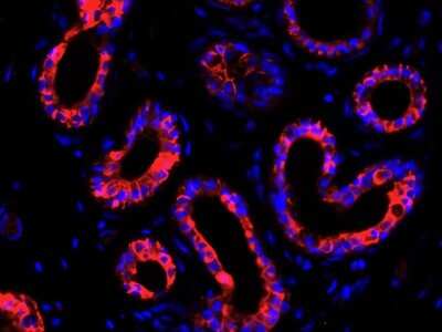 Immunohistochemistry-Paraffin: KRT9 Antibody (SD201-09) [NBP2-67810]