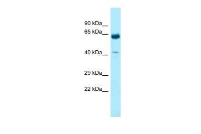 Western Blot: KRT9 Antibody [NBP2-85176]