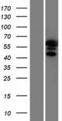 Western Blot: KRT9 Overexpression Lysate [NBP2-09046]