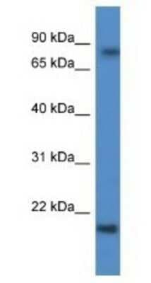 Western Blot: KRTAP1-5 Antibody [NBP1-79847]