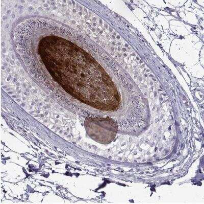 Immunohistochemistry-Paraffin: KRTAP11-1 Antibody [NBP2-55564]