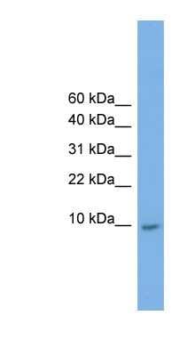 Western Blot: KRTAP23-1 Antibody [NBP1-70596]