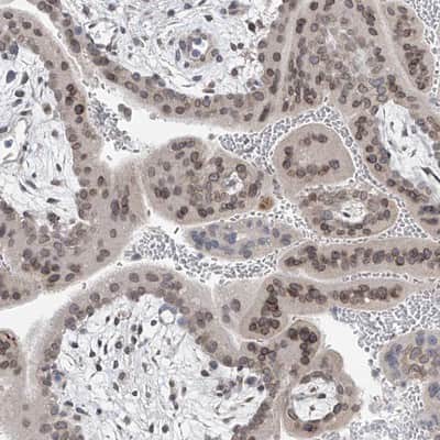 Immunohistochemistry-Paraffin: KRTAP25-1 Antibody [NBP1-93664]