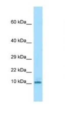 Western Blot: KRTAP3-3 Antibody [NBP1-98505]