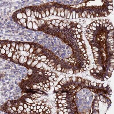 Immunohistochemistry-Paraffin: KRTCAP3 Antibody [NBP2-14179]
