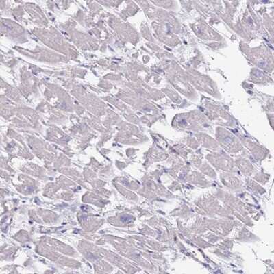 Immunohistochemistry-Paraffin: KRTCAP3 Antibody [NBP2-14179]