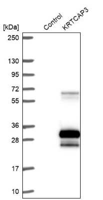 Western Blot: KRTCAP3 Antibody [NBP2-14179]