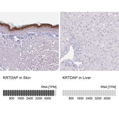 Immunohistochemistry-Paraffin: KRTDAP Antibody [NBP2-38029]
