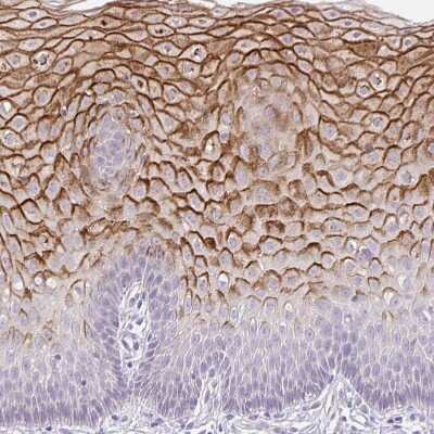 Immunohistochemistry-Paraffin: KRTDAP Antibody [NBP2-38029]